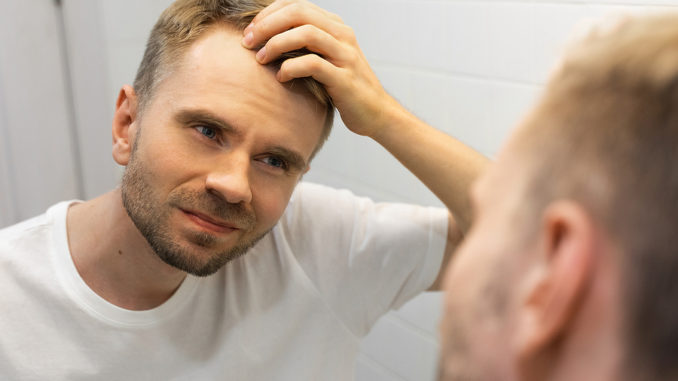 Mittel gegen Haarausfall für Männer