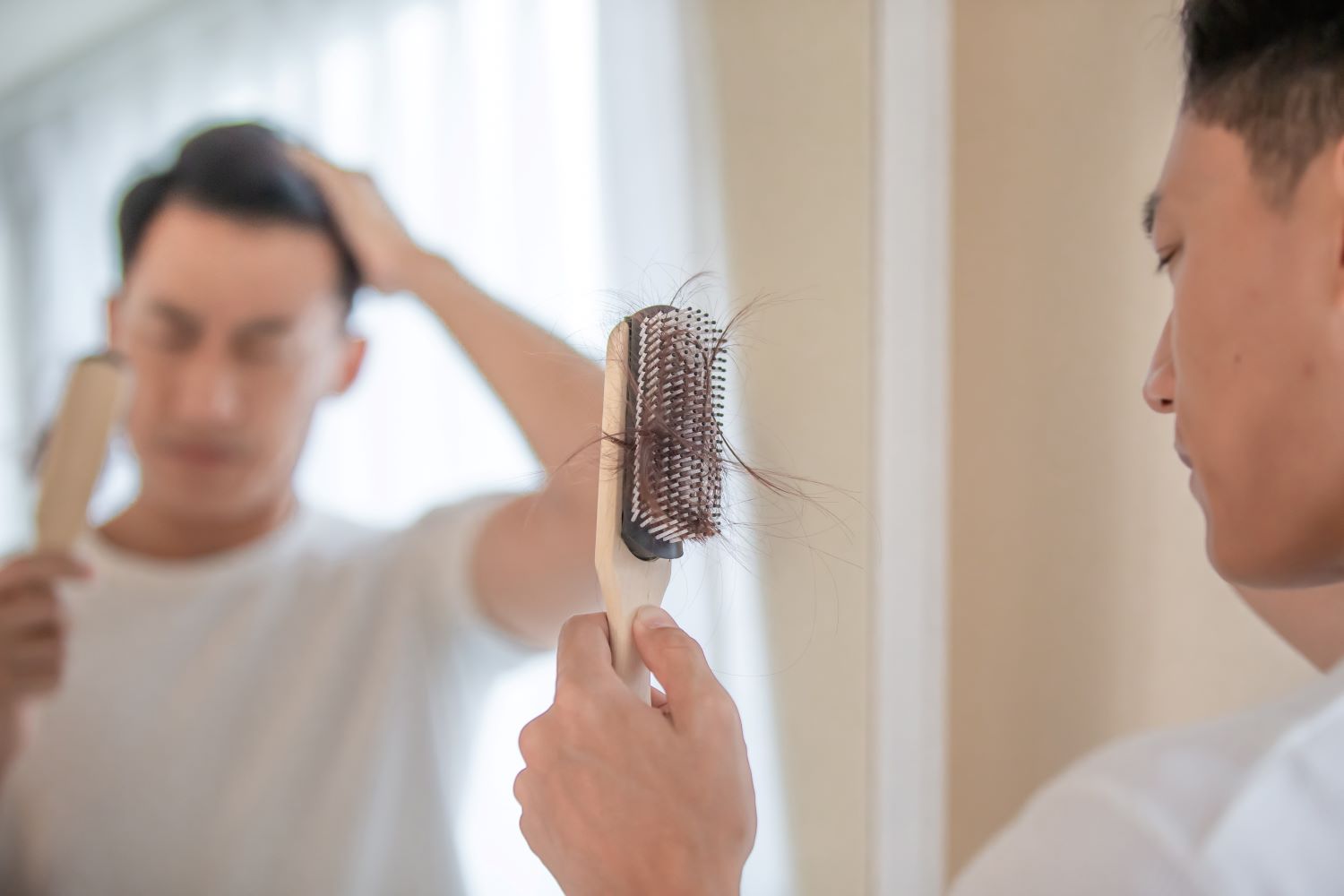PRP Behandlung: Medizinische Haartherapie zwischen Ästhetik, Kontrolle und Realität 1 Ein Mann steht vor einem Spiegel und hält eine Haarbürste mit ausgefallenen Haaren in der Hand